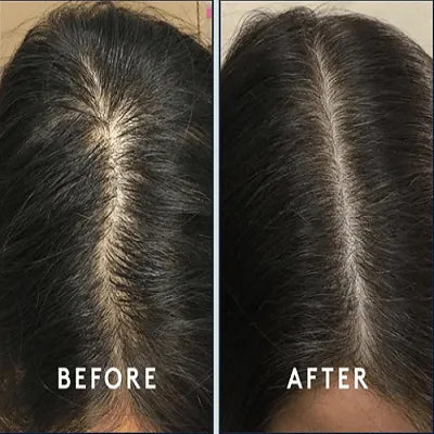 DBS Herbal Infused Hair Oil – 120ML